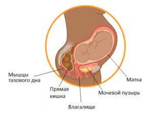 Кишечник давит на матку