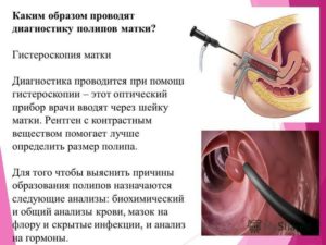 Лечение после гистероскопии матки