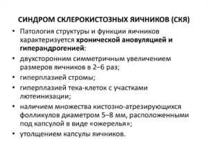 Синдром склерокистозных яичников