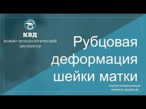 Лечение рубцовой деформации шейки матки