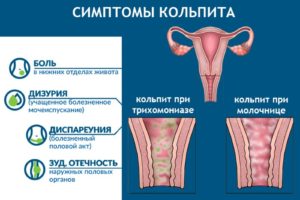 Возрастной кольпит у женщин лечение