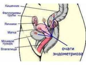 Расположение кишечника и матки