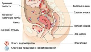 Расположение кишечника и матки