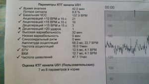 КТГ плода при беременности: показатели, результаты