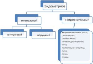 Наружный и экстрагенитальный эндометриоз