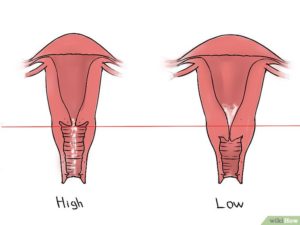 Шейка матки расположена низко