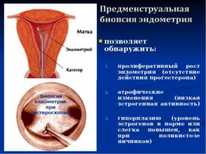 Причины маленького эндометрия