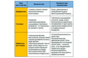 Боли при мастопатии