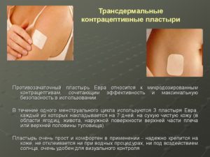 Противозачаточный пластырь Евра: цена и инструкция