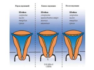 Матка опустилась перед месячными