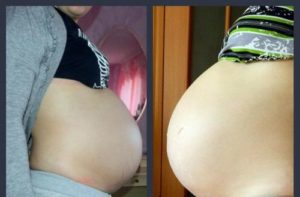 39 неделя беременности: тянет и каменеет живот