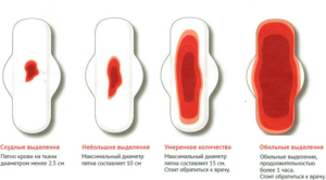 Сколько крови при месячных теряет женщина