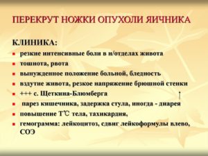 Перекрут ножки опухоли яичника