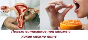 Витамины при миоме матки