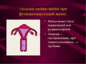 Лечение аплазии матки и ее шейки