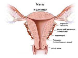 Утолщение стенок матки что это такое