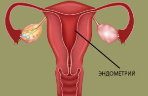 Что такое эндометрий тела матки