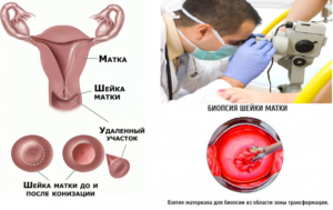 Выделения после биопсии