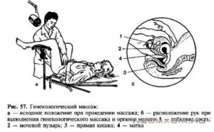 Гинекологический массаж при спайках