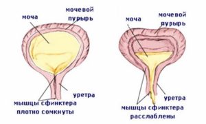 Слабость мочевого пузыря у женщин лечение