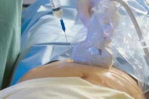 Инвазивная диагностика при беременности