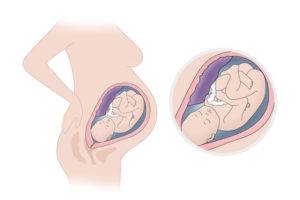 37 недель беременности: предвестники родов, болит поясница