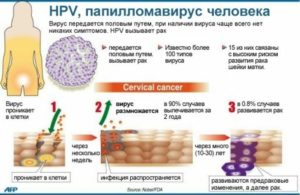 Hpv инфекция у женщин что это