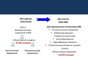 Что такое мастодиния