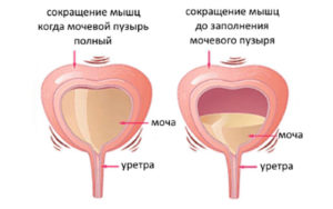Ощущение наполненности мочевого пузыря у женщин