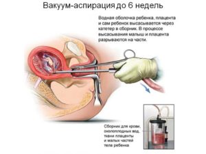 Вакуумный оборот как происходит