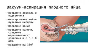 Беременность после вакуум аспирации