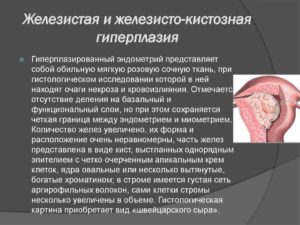 Что такое железистая гиперплазия эндометрия