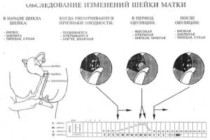 Шейка матки расположена низко