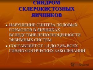 Синдром склерокистозных яичников