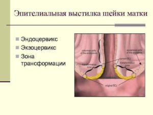 Что называют эндоцервиксом