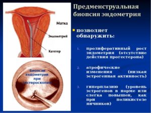 Причины тонкого эндометрия матки