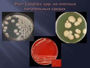 Candida spp что это