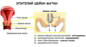 Что такое цилиндрический эпителий шейки матки