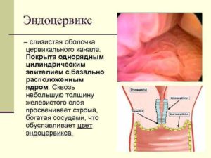 Что называют эндоцервиксом