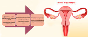 Наращивание эндометрия