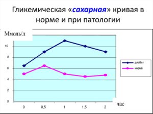 Сахарная кривая при беременности как сдавать