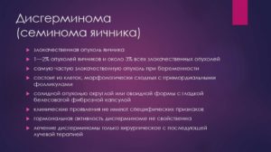 Дисгерминома яичника