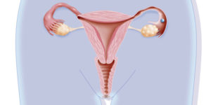 Месячные при внематочной беременности
