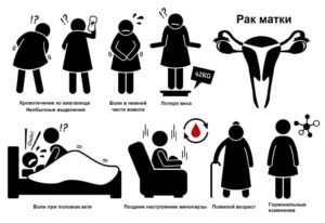 Выделения при раке матки
