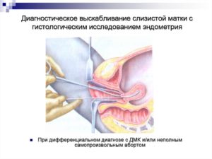 Гистологическое исследование эндометрия матки