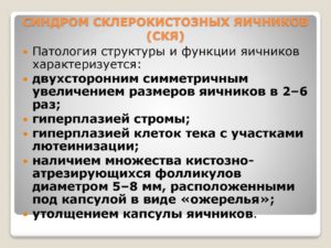 Синдром склерокистозных яичников