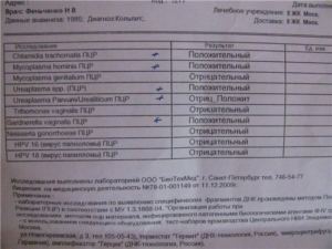 Мазок на скрытые инфекции у женщин