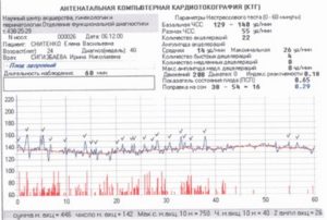 Сколько по времени делают ктг при беременности