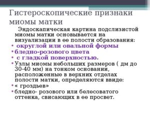 Как распознать признаки миомы матки