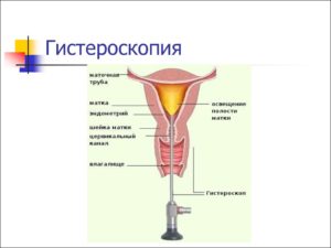 Что такое цервикальный канал и шейка матки